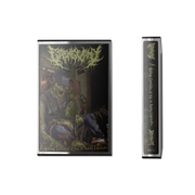 Esophagectomy - A Noxious Culmination Of Tools For Auditory Extermination cassette