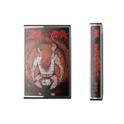 Monumental Discharge / Putrid Defecation - Monumental Putridity cassette