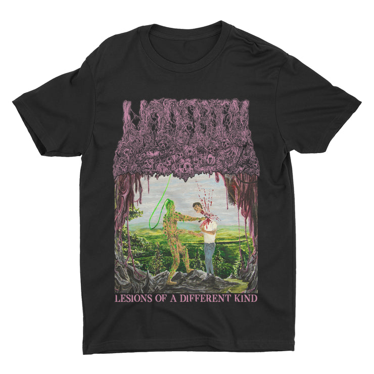 Undeath - Lesions Of A Different Kind t-shirt